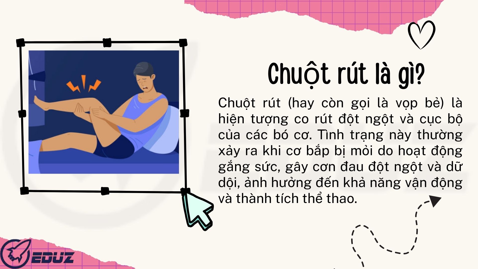 1. Chuột rút là gì?